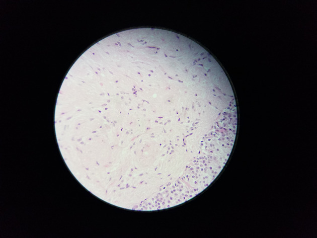 Pituitary Gland Slides - Pituitary Gland 008 400X